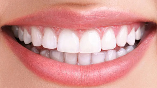 Эстетическая стоматология: отбеливание, виниры, коронка E.Max